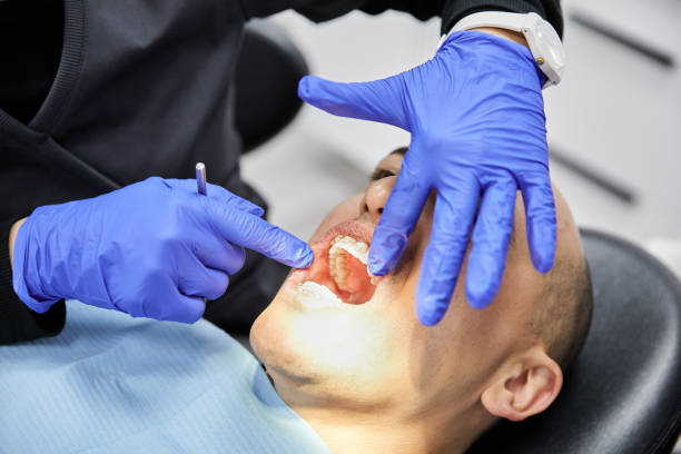 Best Knocked-Out Tooth (Avulsed Tooth) Treatment in , DE